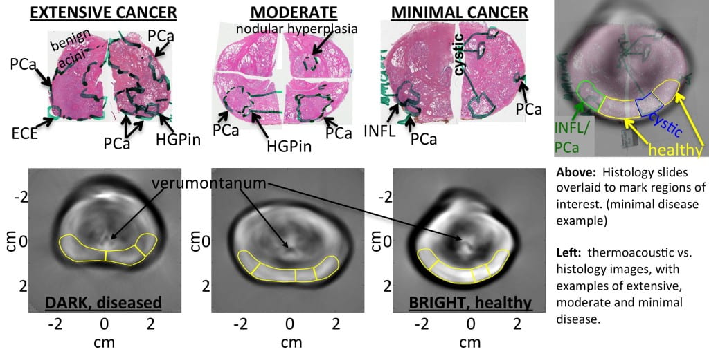 Imaging of different stages of cancer
